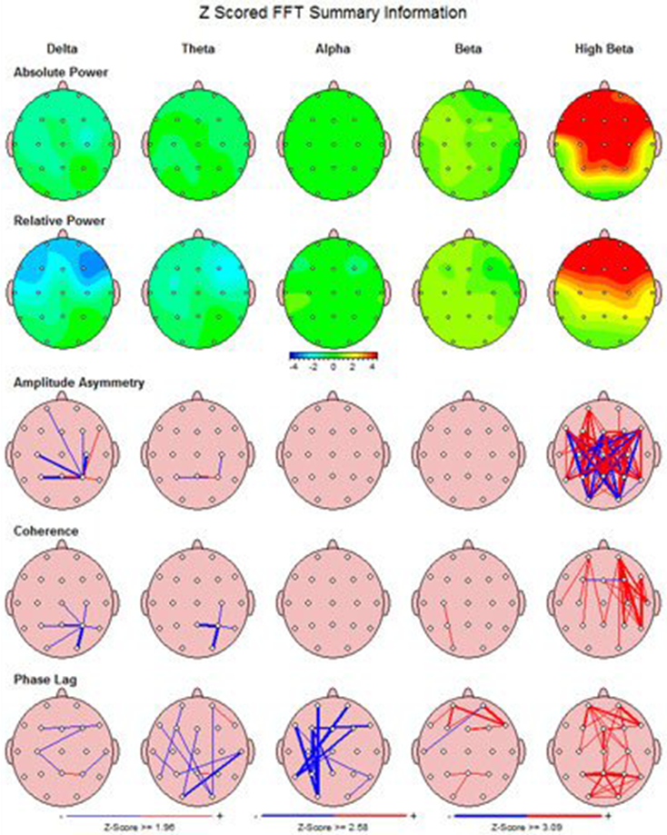 watsonphc-biofeedback-neurofeedback-img3 biofeedback neurofeedback